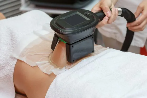 Image of person having fat freezing treatment to help weight gain Middleton Park