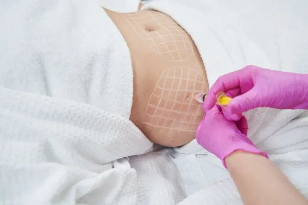 image of fat dissolving injections on love handles to help combat weight gain Middleton Park
