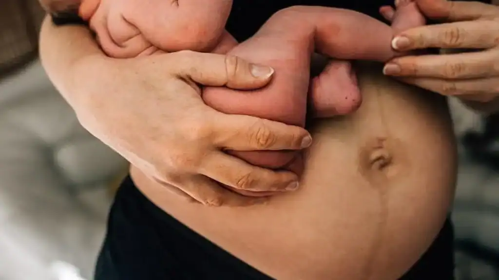 Why Is My Stomach Still Big After Pregnancy Middleton Park?